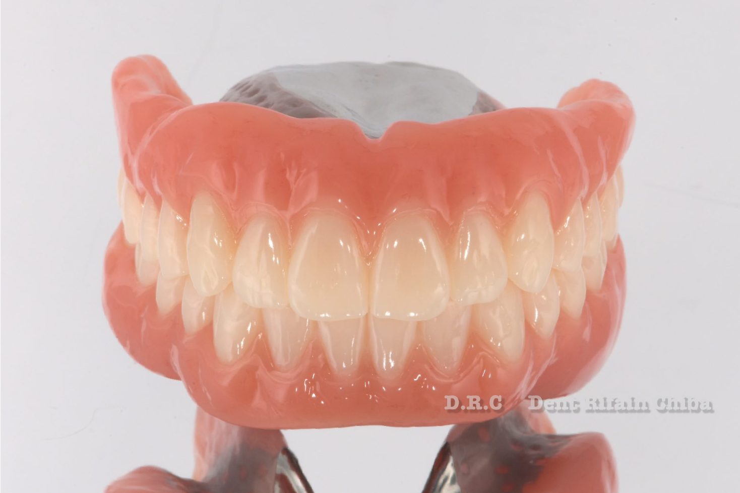 フルカバーレイヤリングPFZ | D.R.C歯科技工所